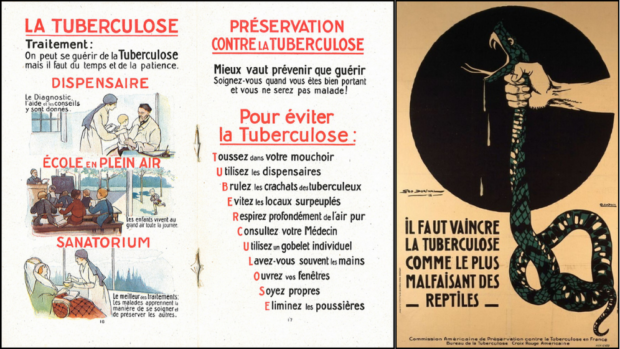 Montage de deux images. À gauche, un document manuscrit accompagné de trois images. Il y est expliqué les principales recommandations pour prévenir et soigner la tuberculose. À droite, une affiche de propagande ou l’on voit une main attraper vigoureusement un serpent venimeux. Un slogan est ajouté à l’illustration : Il faut vaincre la tuberculose comme le plus malfaisant des reptiles. 